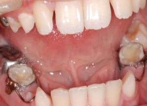 فضانگهدار دندان کودکان